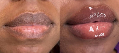Plumping Lip filler