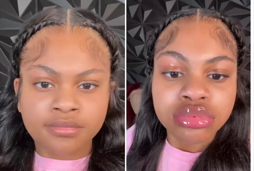 Plumping Lip filler
